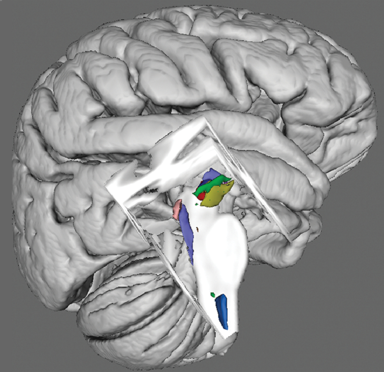 Brainstem Nuclei Atlas